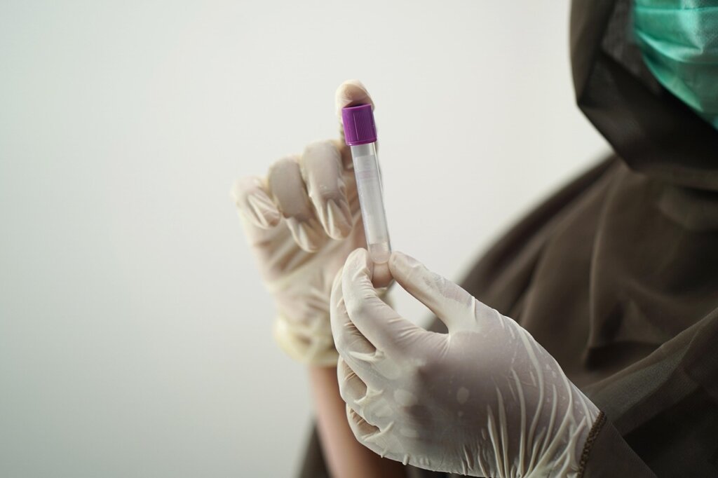 blood test tube labeled thyroid panel in laboratory setting